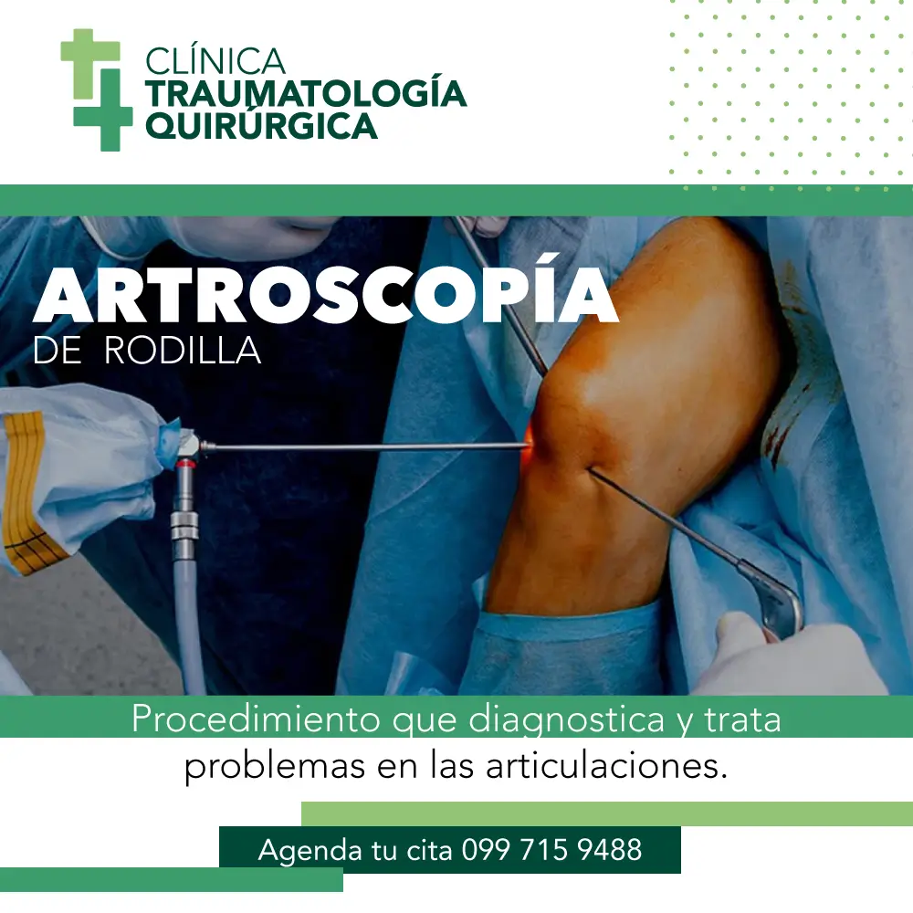 Dr_David_Cabrera_ dr_david_cabrera_artroscopia_de_rodilla