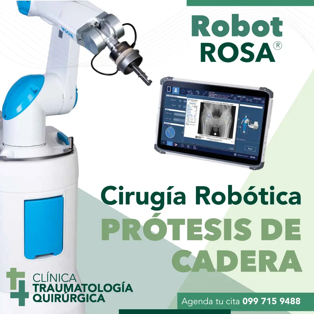 Dr_David_Cabrera_ dr_david_cabrera_protesis_de_CADERA